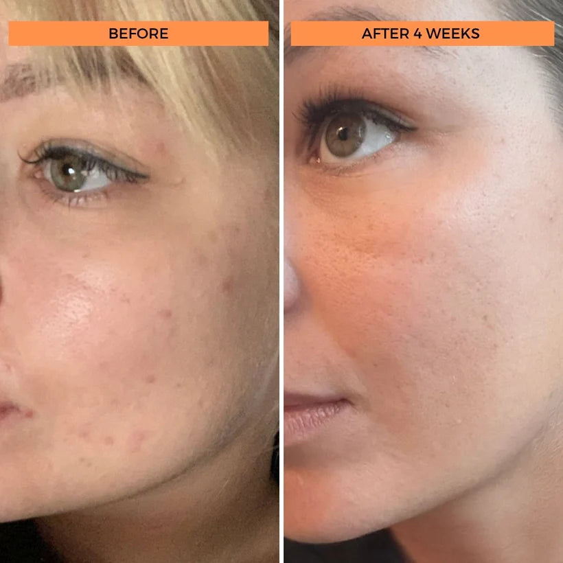 Universal C Skin Refining Brightening Serum