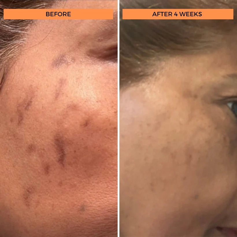 Universal C Skin Refining Brightening Serum