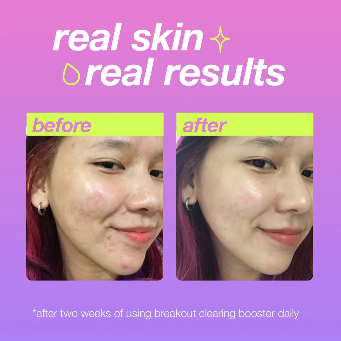 Dermalogica Clear Start