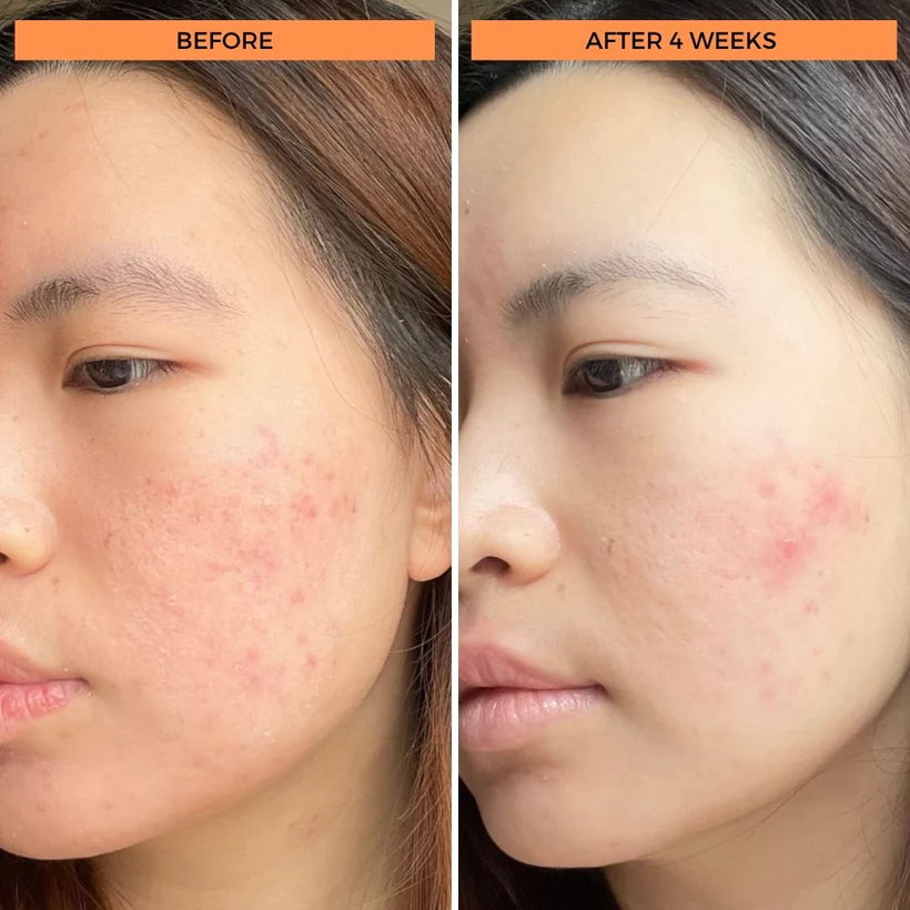 Universal C Skin Refining Brightening Serum