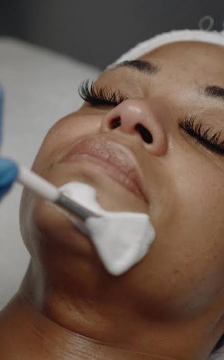 Chemical Peel coming soon (January 2027)